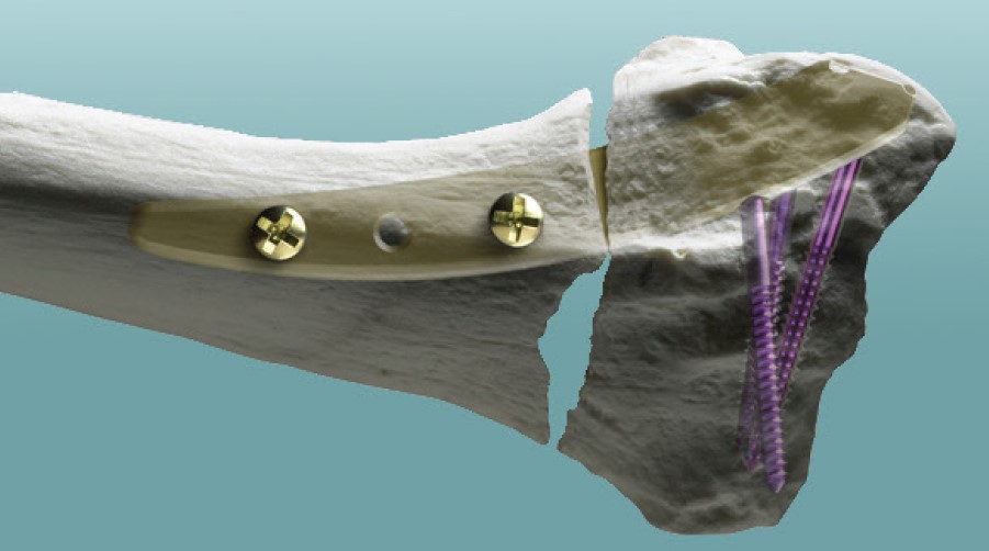 bone-cad-model